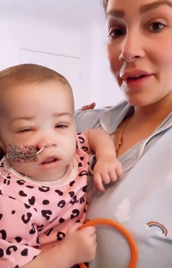 The severe swelling on their daughter's face is preventing her from opening her eyes