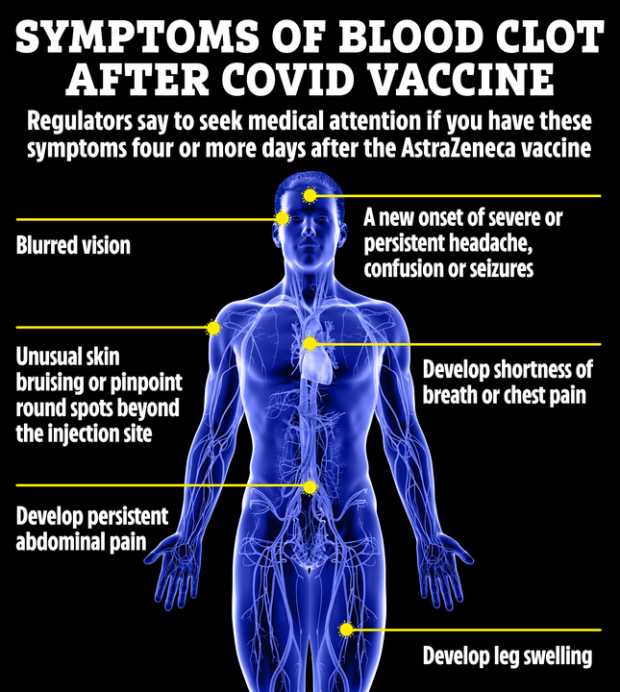 Symptoms of blood clots that regulators have warned to watch out for after having the AstraZeneca jab. There is no sign at this stage that the symptoms are different in relation to the Janssen jab