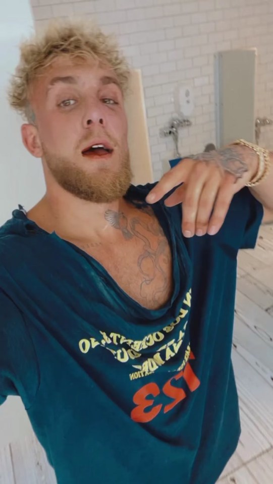 Jake Paul showed off his black eye after the confrontation