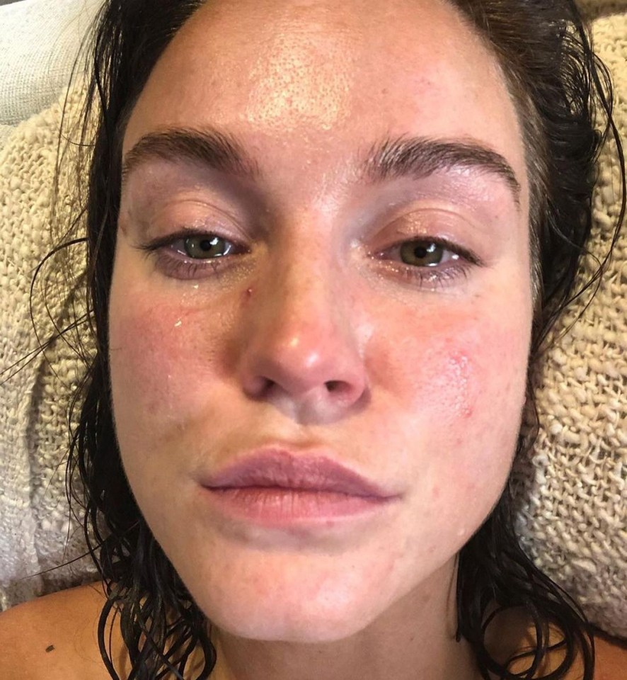 Vicky Pattison bravely shared a post about her previous mental health struggles