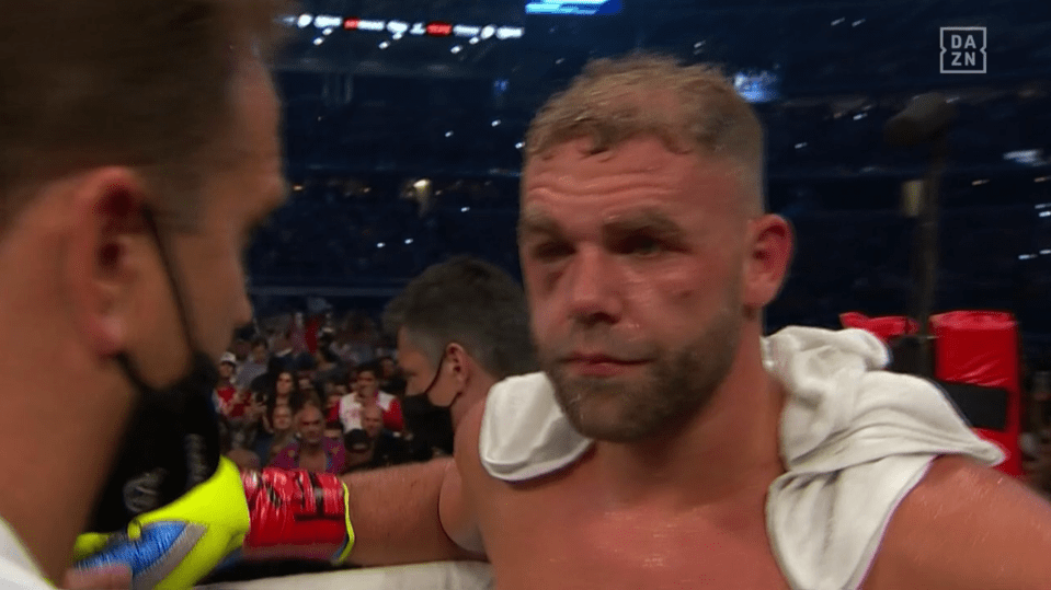 Billy Joe Saunders was forced to retire on his stool after right rounds