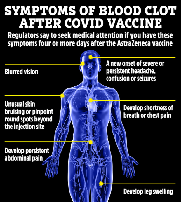 The key signs of a blood clot related to the AstraZeneca vaccine