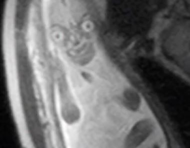 They look less than angelic when an MRI takes a scan of them in their mums