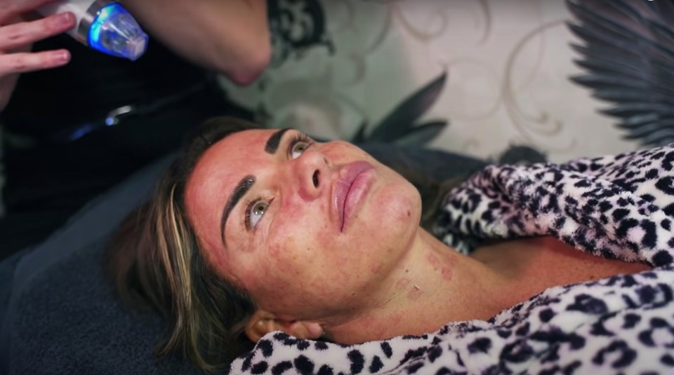 Katie Price was left wincing in agony at painful needling facial