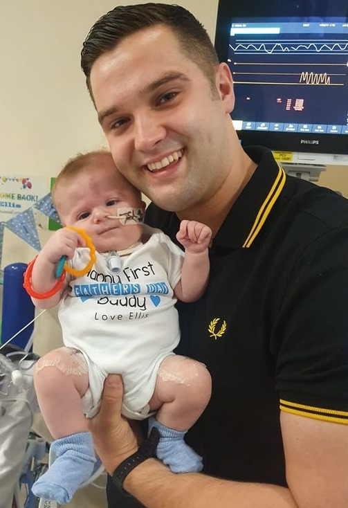 James said his son's SCID diagnosis 'threw all of the other problems out of the window'