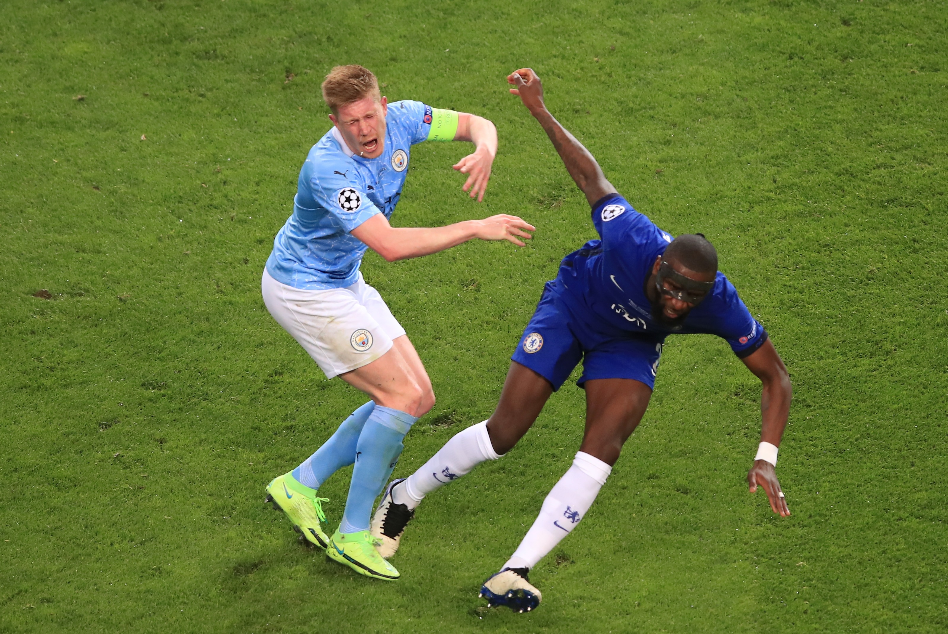 Kevin De Bruyne suffered an orbital fracture in a collision with Antonio Rudiger during the Champions League final