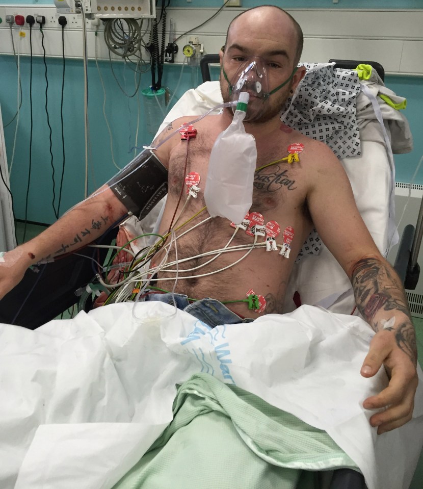 Josh Rose thought he was going to die and needed intensive care treatment following his bite