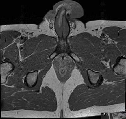 The image above shows what medics referred to as the ‘vertical disruption’ to the penis