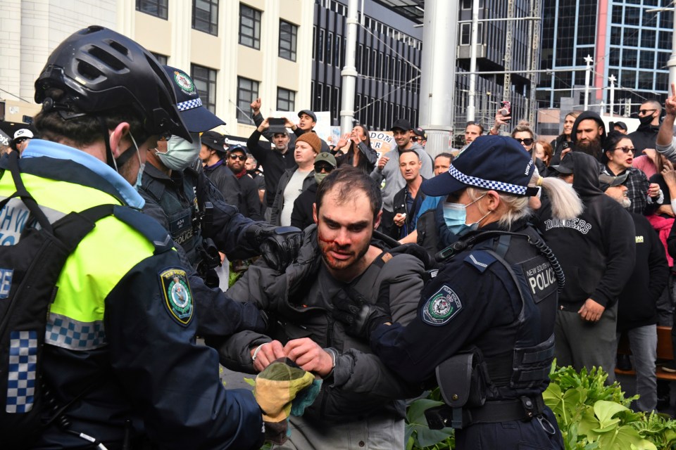 A man with a bloodied face is arrested by police during anti-lockdown protests in New South Wales last year