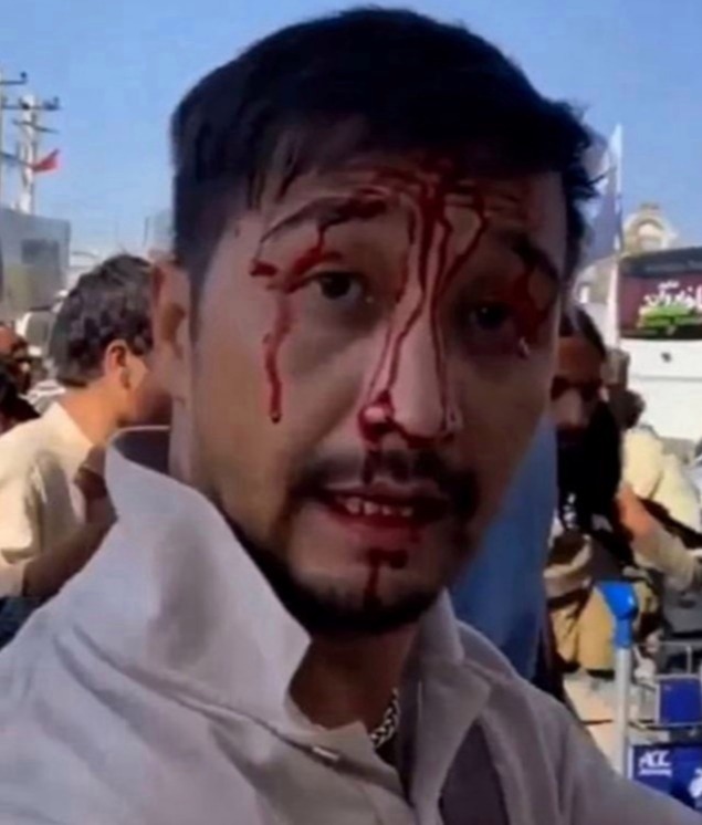 One man said he was beaten and bloodied at a checkpoint on the way to the airport today