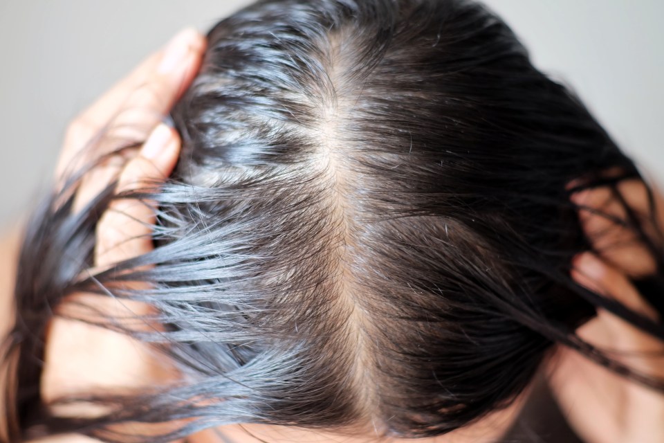 A study by anti-hair loss brand Nioxin found 59 per cent would hide thinning from strangers, work colleagues and even their own friends and family