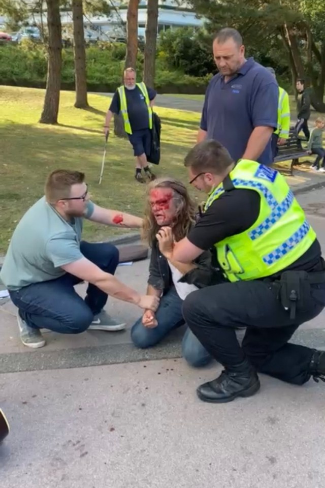 This busker suffered a bloody face while a member of the public pleaded with the officer to let him go