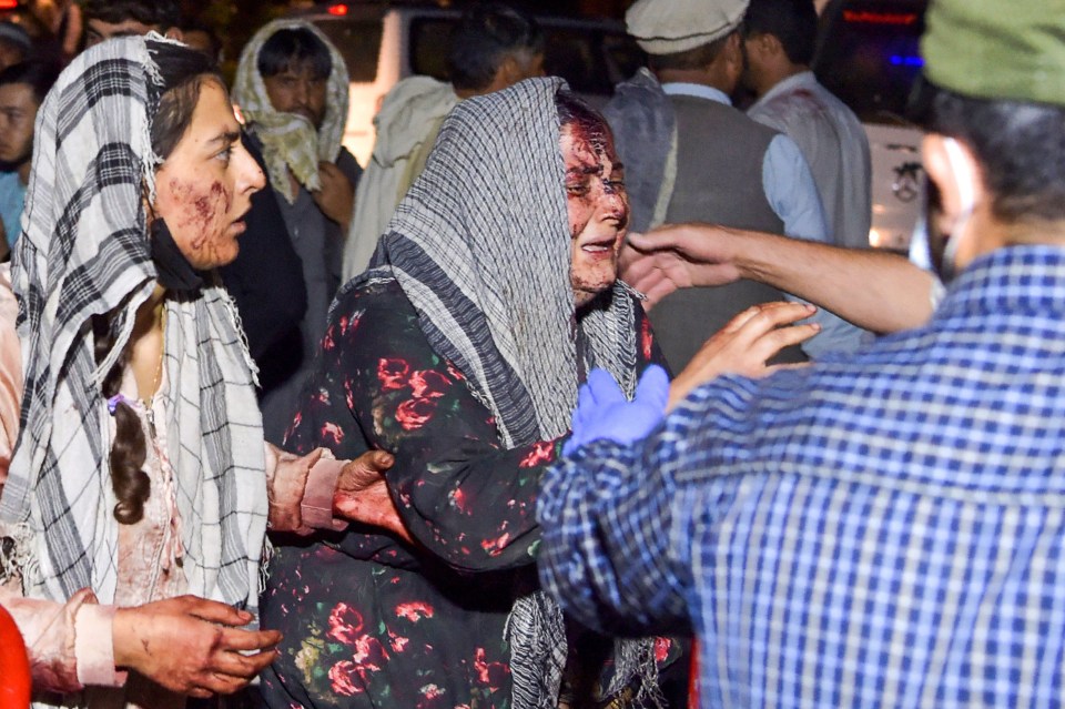 Wounded women arrive at a hospital for treatment in Kabul