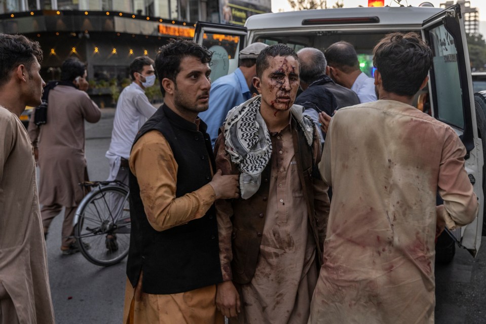 Bombing victims are flooding Kabul hospitals, which are at breaking point