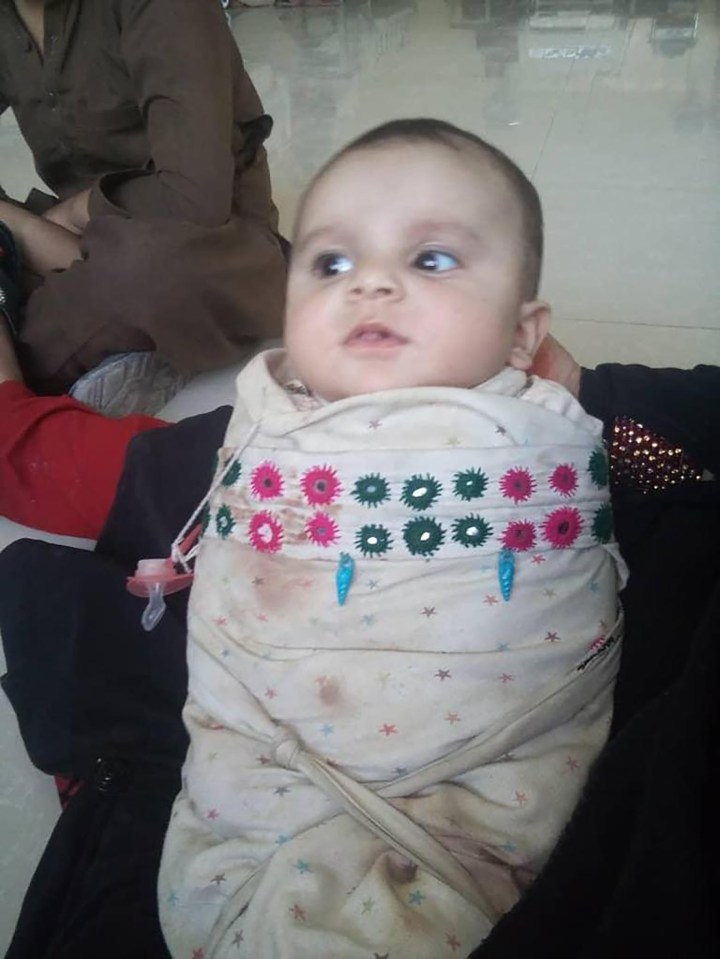 Brave Muhammad has already had surgery in Afghanistan where he remains with his five-month-old sister, Kalsoom, pictured