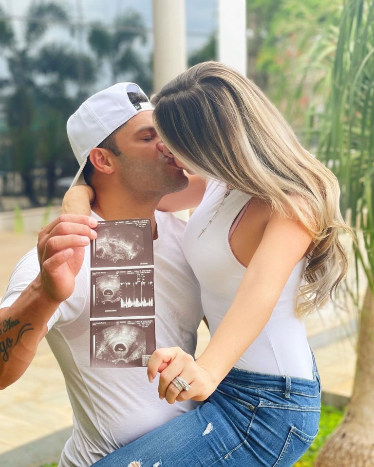 Brazilian footballer Hulk shares a kiss with Camila, as well as their baby scan