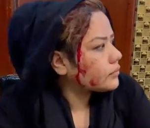 One activist was left bloody as she was allegedly struck across the head by a Taliban fighter