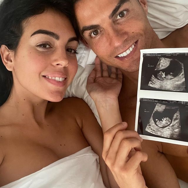 The couple announced yesterday they were expecting twins