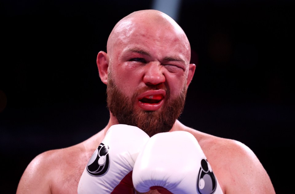 Adam Kownacki was left with a bruised eye