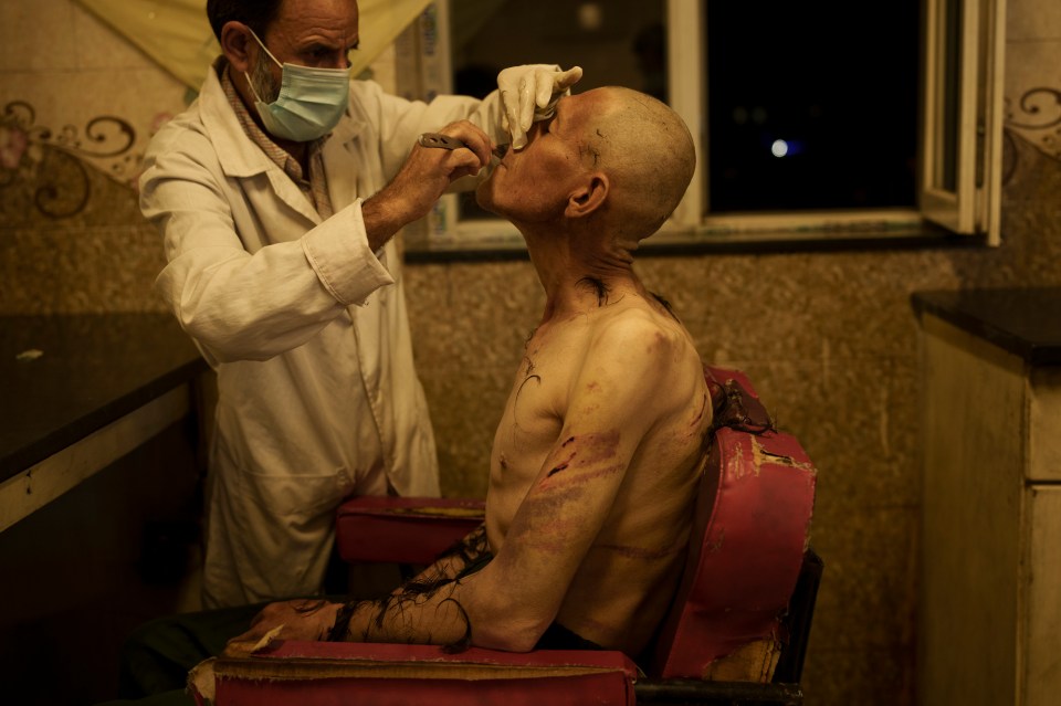 An Afghan covered in scars is shaven in the treatment centre