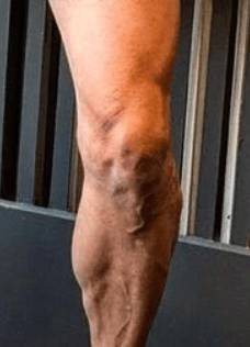 But fans spotted Harry Potter villain Voldermort in his knee