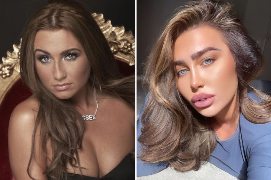 Lauren Goodger has had Botox, lip fillers, jawline fillers and more