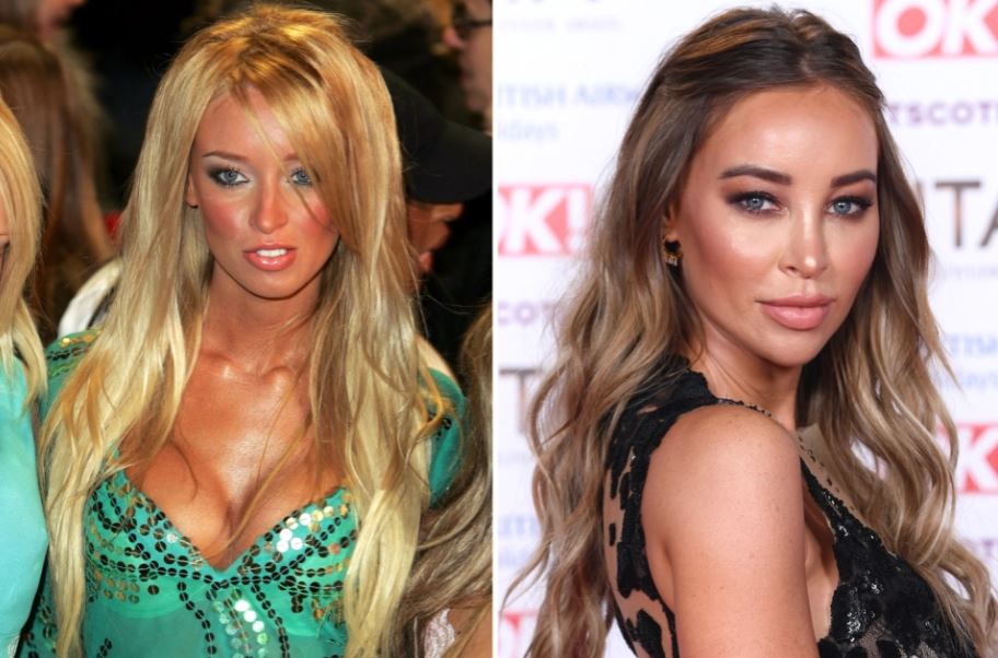 Lauren Pope used to have Botox but claimed it made her look 'like Spock' from Star Trek