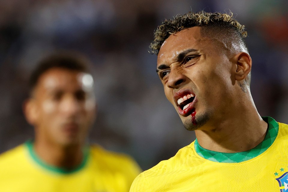 Leeds star Raphinha bled profusely after suffering a deep cut on his lip from Nicolas Otamendi's blow