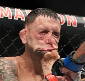 A close-up of Frankie Edgar's scrunched up face at the moment of impact