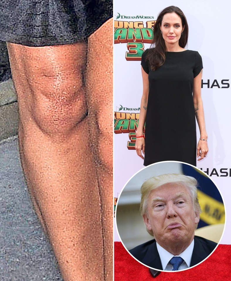 Who can Trump Angelina Jolie's celebrity knee?