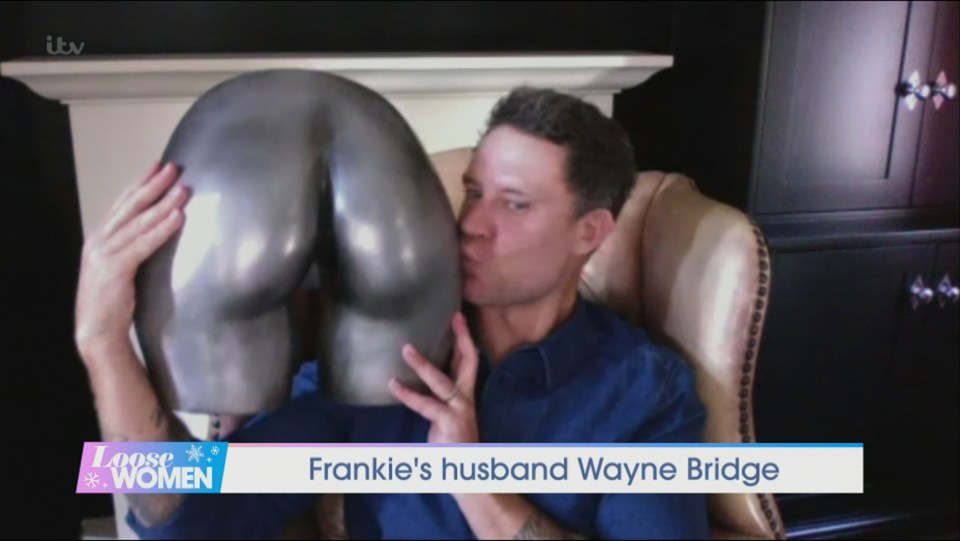 Wayne has a cast of Frankie's bum