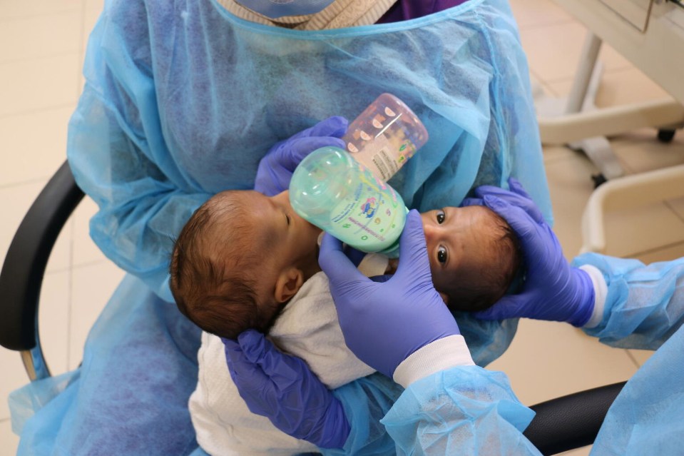 Conjoined twins Mohamed and Ahmed with their nurses at the Specialty Hospital in Amman, Jordan