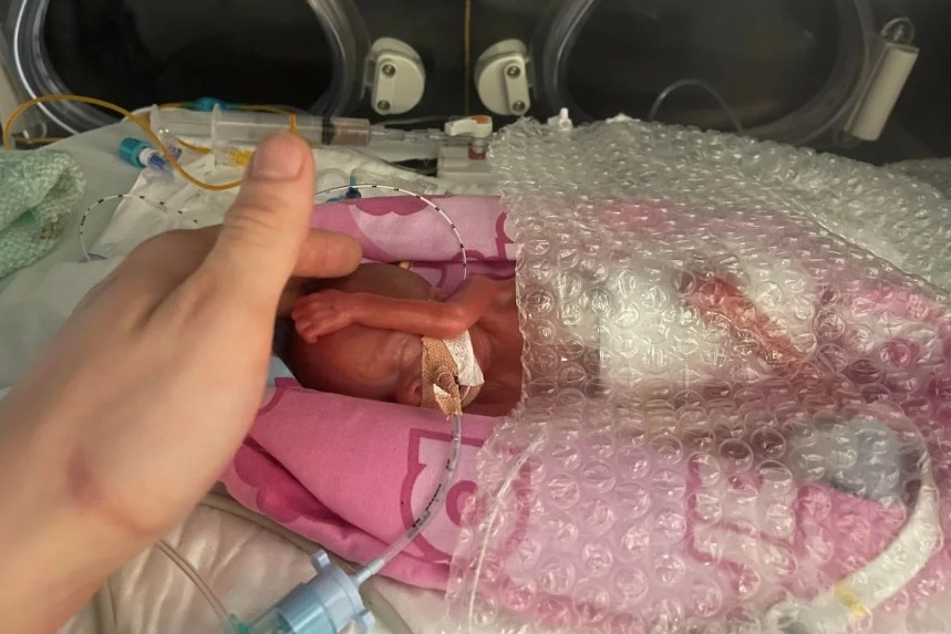 Hannah Stibbles weighed just 325g (11oz) at birth. She has to have bubble wrap as a blanket