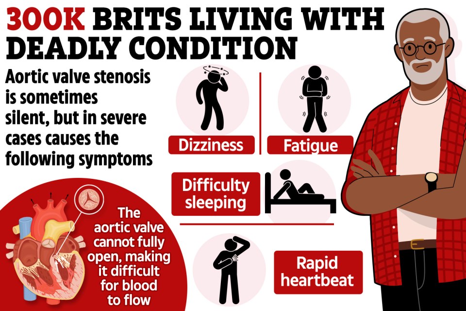 The symptoms of aortic valve stanosis, when it shows