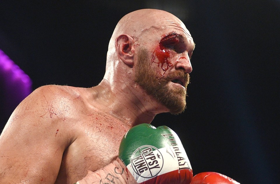 Tyson Fury's gruesome gash against Otto Wallin