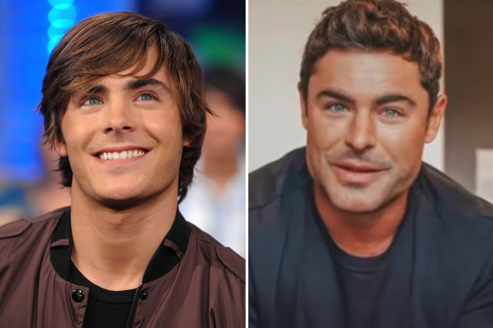 Zac Efron’s friend denied he had any plastic surgery