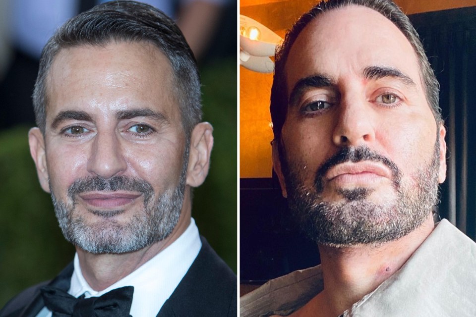 Fashion designer Marc Jacobs charted his facelift online for his fans