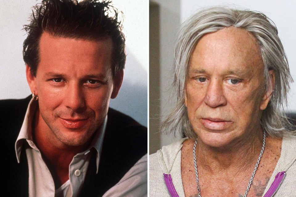 Mickey Rourke said his boxing led to him having his face reconstructed