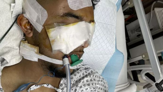 A fundraiser has been launched after a man, Subby, fell from a roof in Pakistan