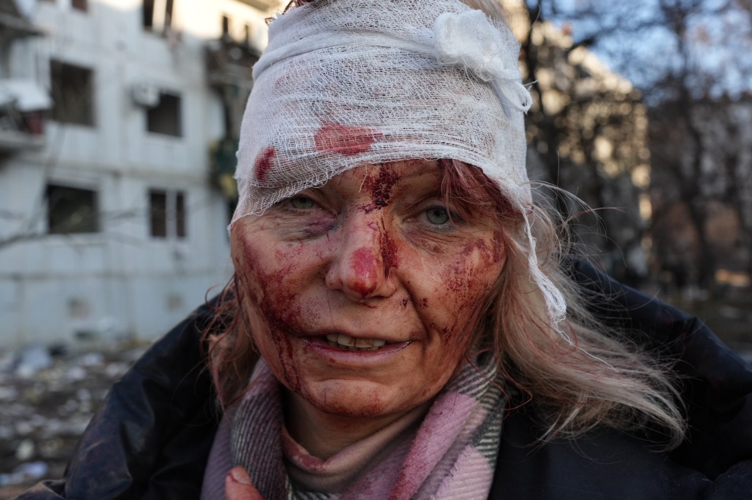 An injured woman pictured after the airstrike in Chuguiv near Karkhiv