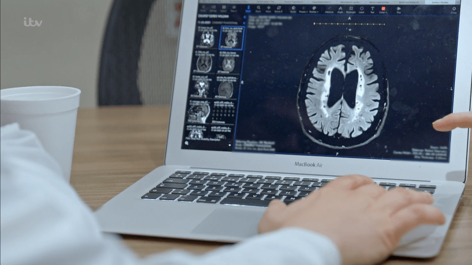 Kate is shown looking at Derek's brain scans on a laptop