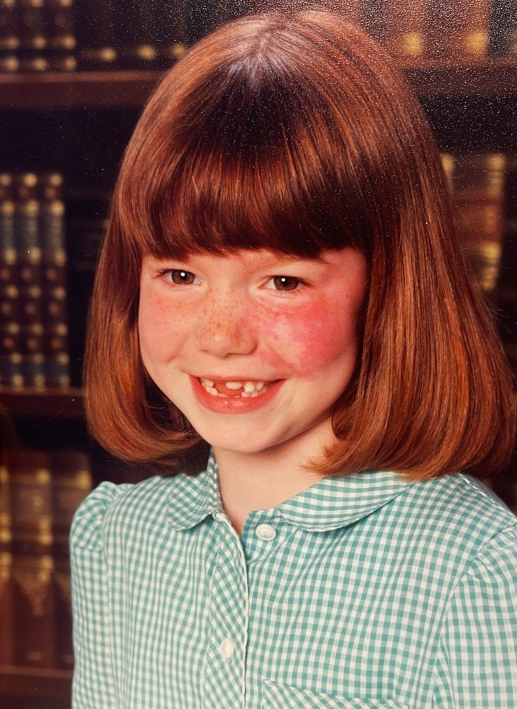 Bullies called Emily ‘burn face’ when she was growing up