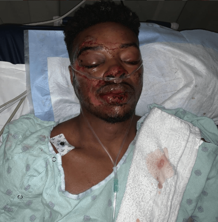 Errol Spence Jr was hospitalised after his horror 2019 car crash