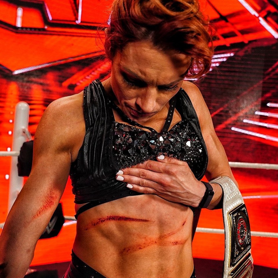 Becky Lynch suffered some gruesome gashes during Monday Night RAW