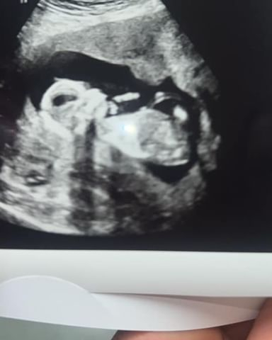 Josie announced baby six with this scan picture