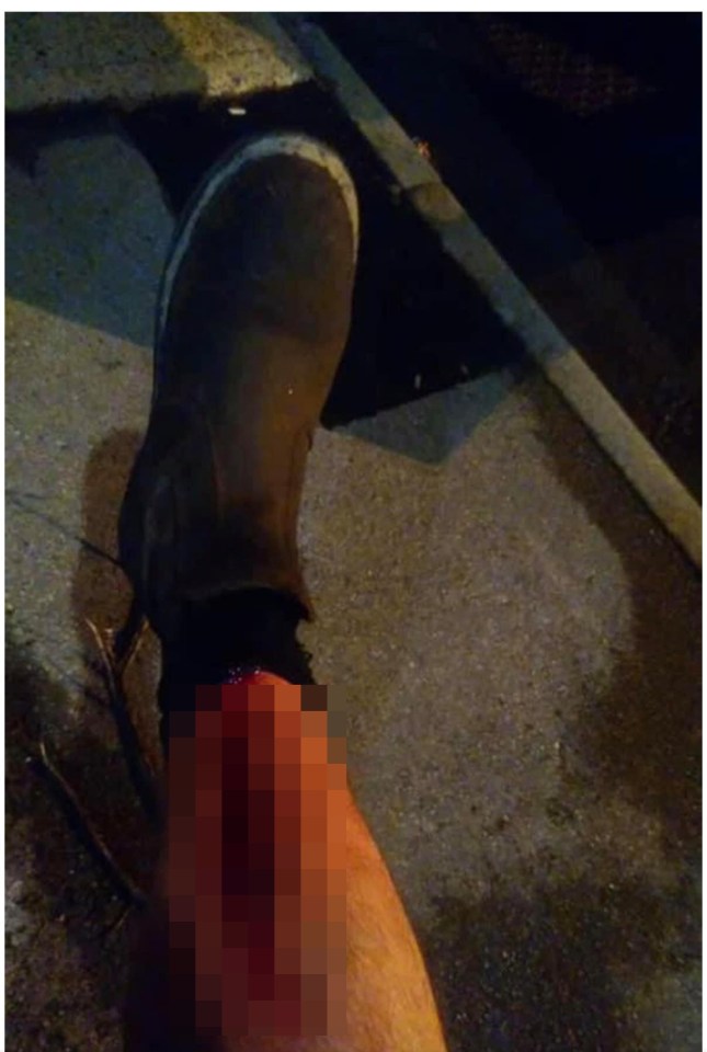 One driver reported being attacked with an axe, leaving a shocking wound