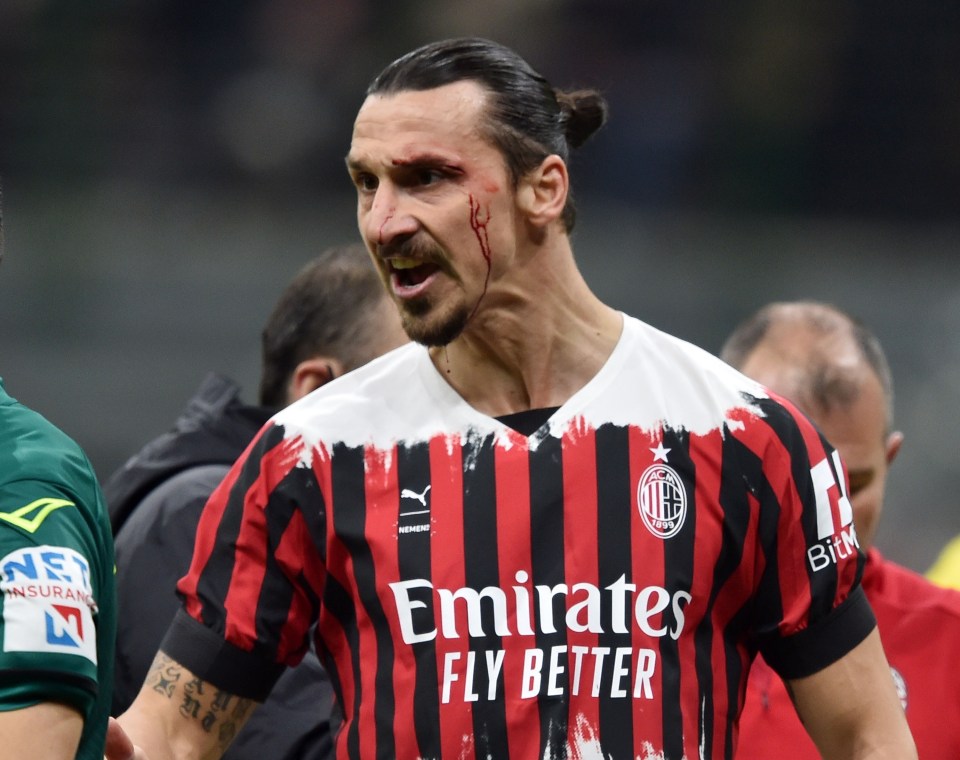 Zlatan Ibrahimovic was left a bloody mess following a clash of heads with Gary Medel