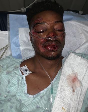 Errol Spence Jr was left hospitalized after a horror crash in 2019