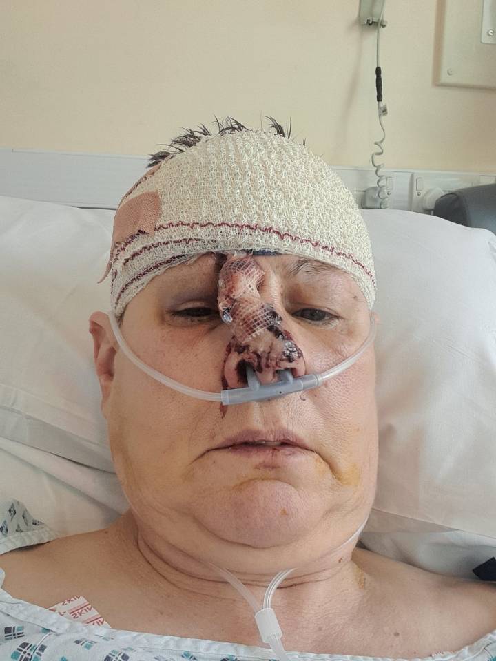 Sam Lodge, 53, was bitten in the face by a dog on Weelsby Street, Grimsby on Friday April 1