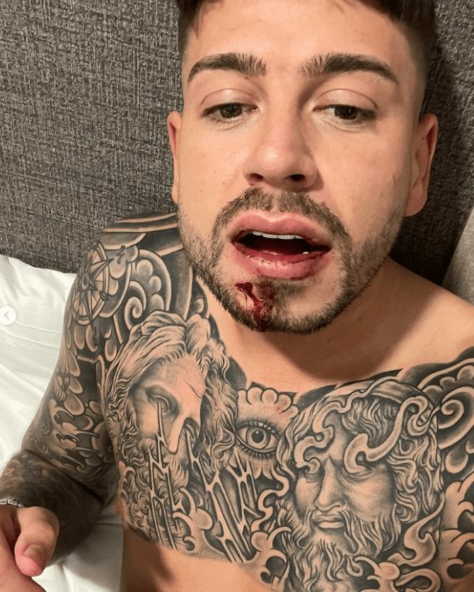 Geordie Shore's Ant Kennedy has been brutally attacked